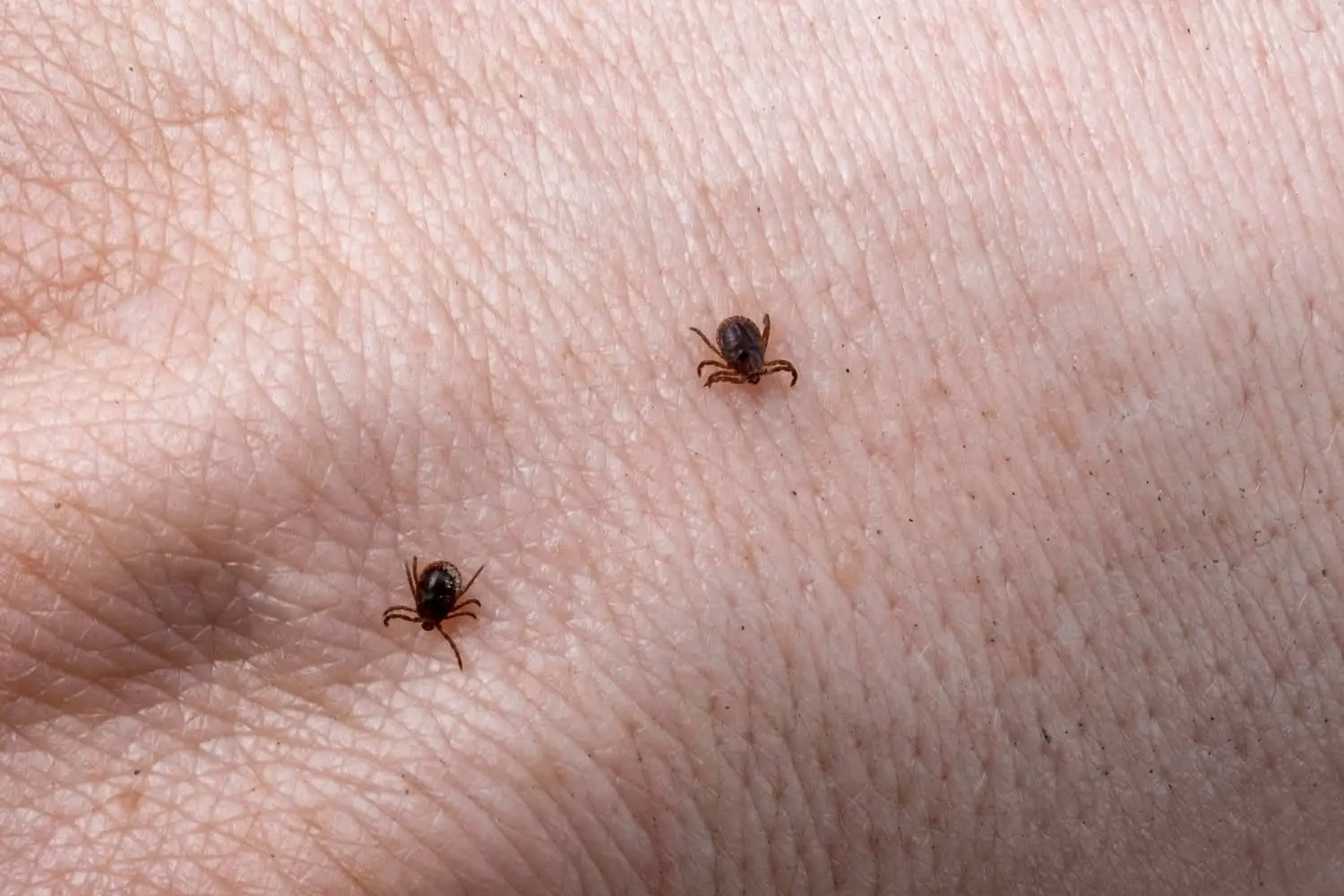 mite-male-hand-with-ticks